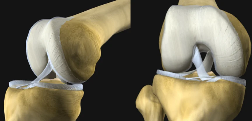 anterior cruciate ligament injury