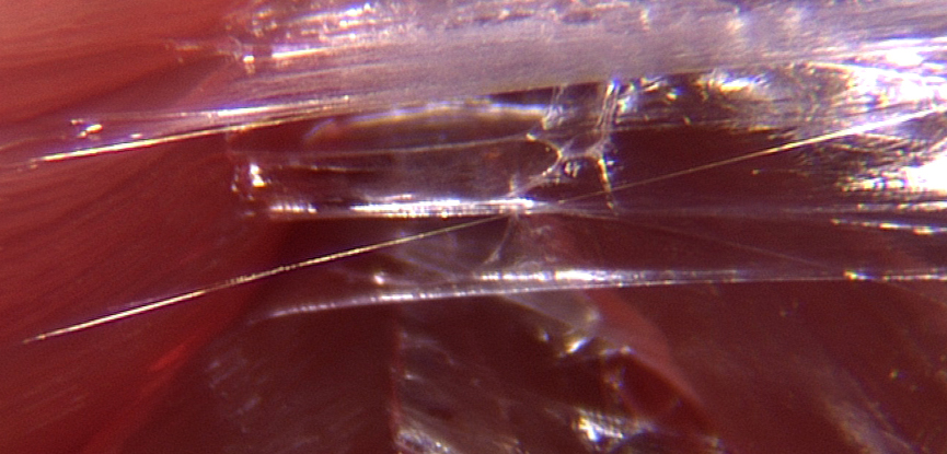 A close up of fascia