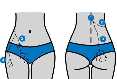 Maigne S Syndrome Thoracolumbar Junction Dysfunction