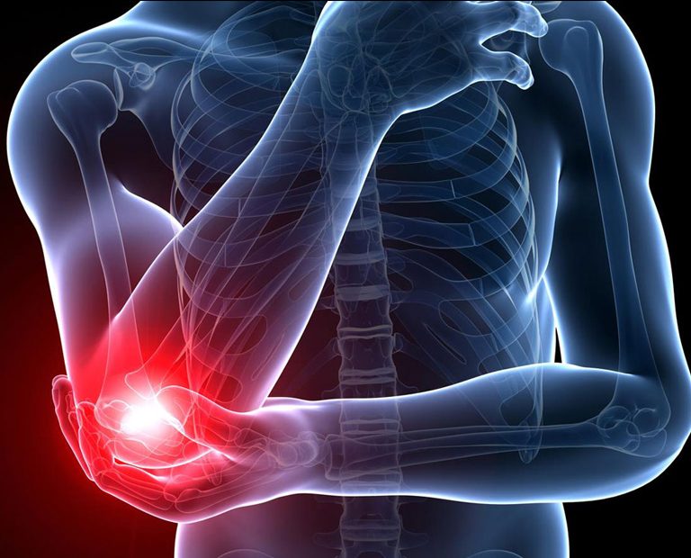 Tennis elbow pain stock image