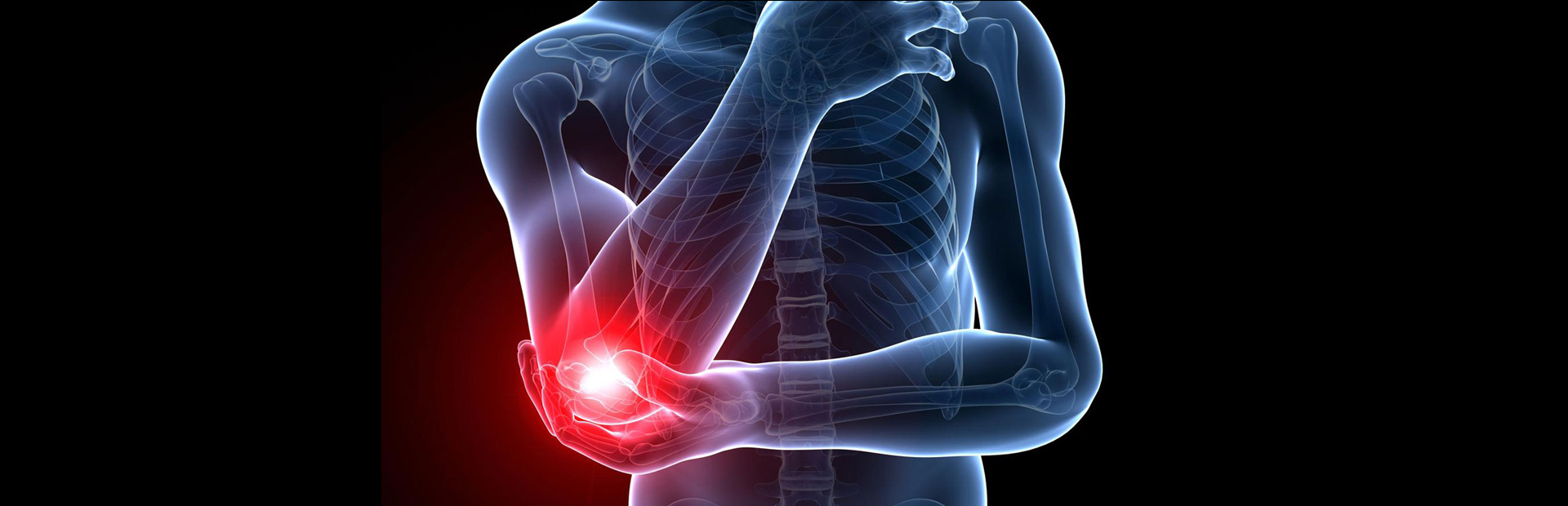 Tennis elbow pain stock image