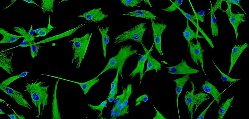 A microscopic image of fibroblasts