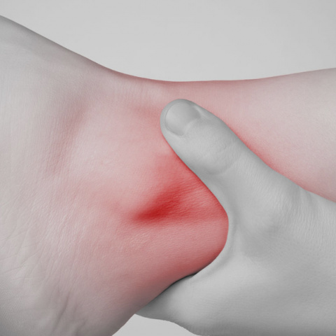 Person holding their injured ankle which is highlighted in red to show inflammation