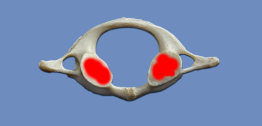 A photography of the first cervical vertebra