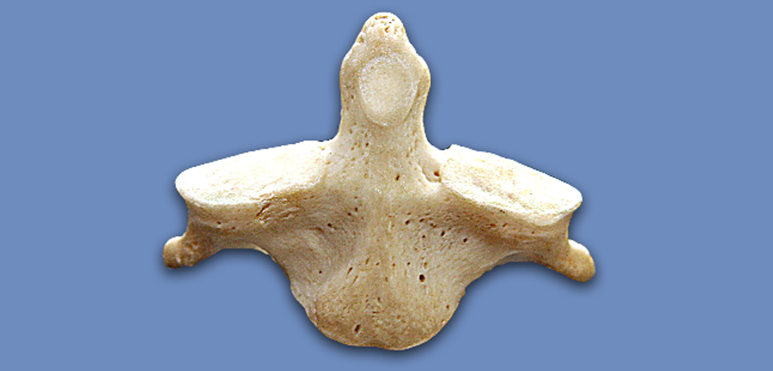 A photograph of the second cervical vertebra