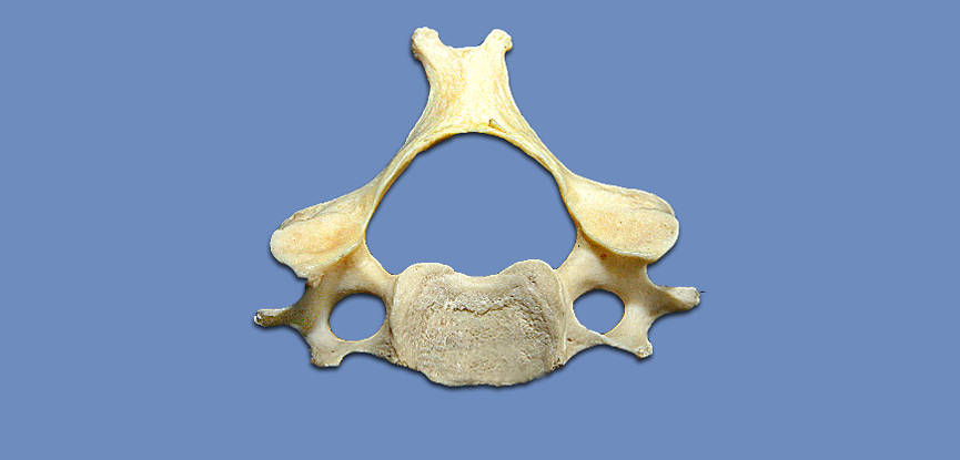 A typical cervical vertebra