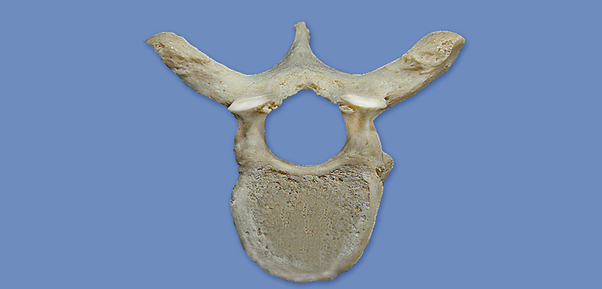A photograph of a typical thoracic vertebra