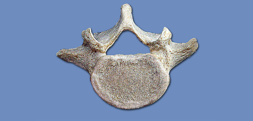 A photograph of a typical lumbar vertebra