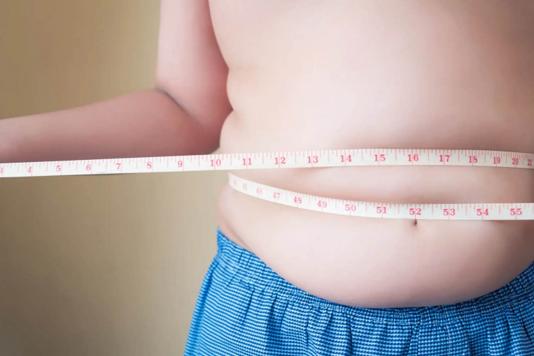 Level 3 Understanding and Managing Childhood Obesity