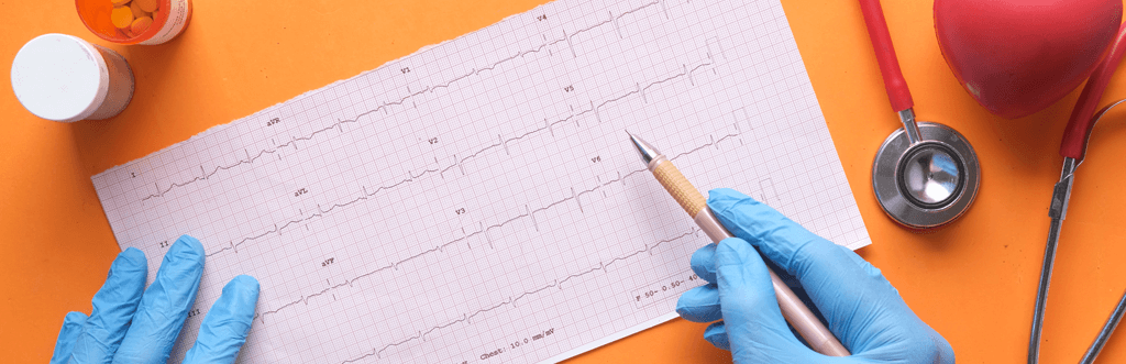 Doctor with ECG results and heart medication