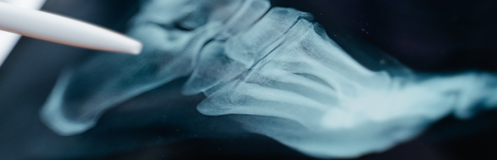 x-ray used to determine whether or not an ankle injury is present