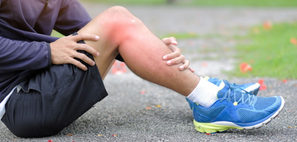 How to Prevent Common Running Injuries: A Therapist’s Guide